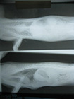 Dijafragmatska hernija kod mačke - posle operacije