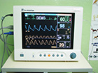 Monitoring - EKG,krvni pritisak,telesna temperatura conc CO2,conc O2,broj respiracija
