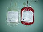 Krvna plazma i uobličeni krvni elementi
