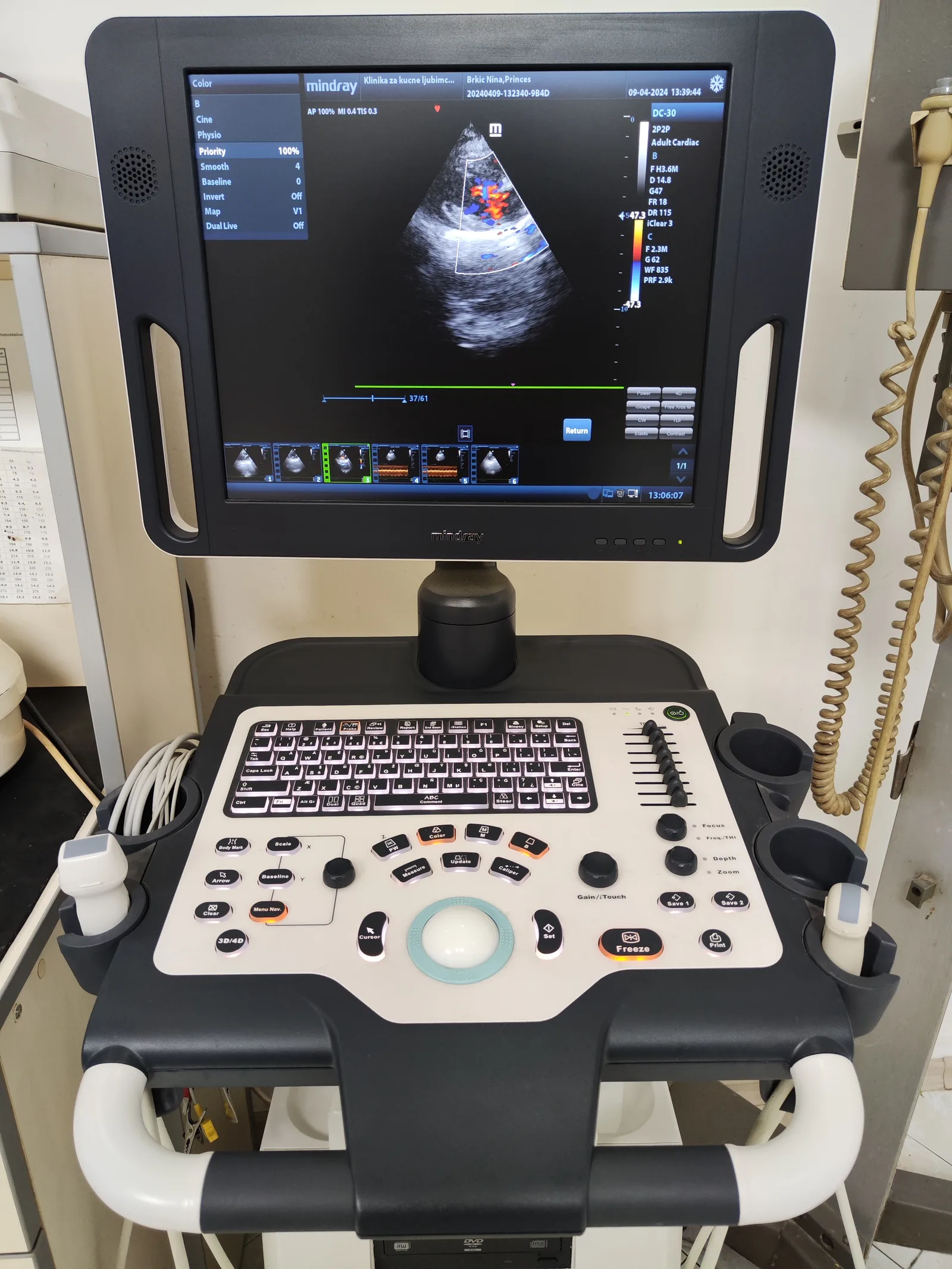 EHO srca, Color Doppler